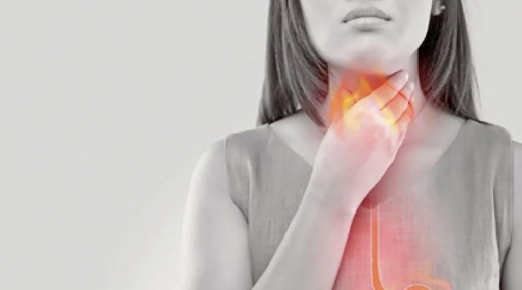 Recomendaciones para aliviar el reflujo estomacal&nbsp;naturalmente