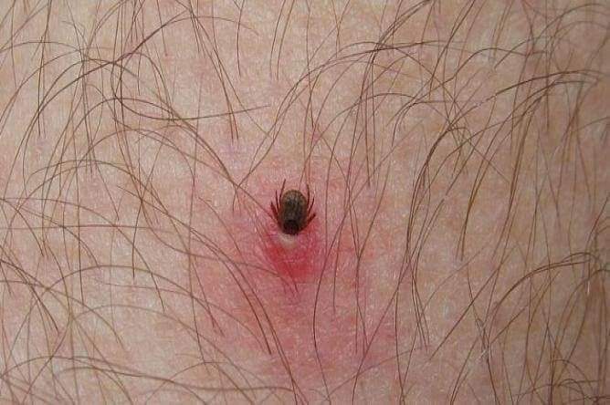 TOMA PRECAUCIONES CONTRA LA&nbsp;RICKETTSIA.