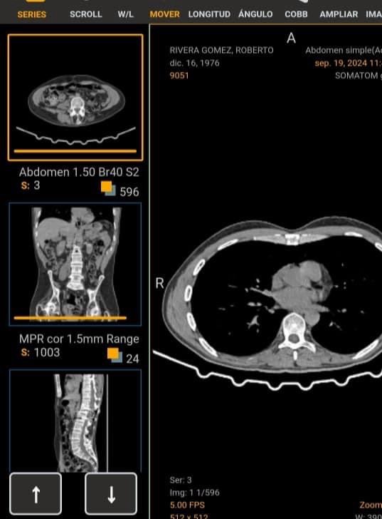 URIEL NOS NECESITA, ¡AYUDEMOS! 🙏❤️🩹🦽