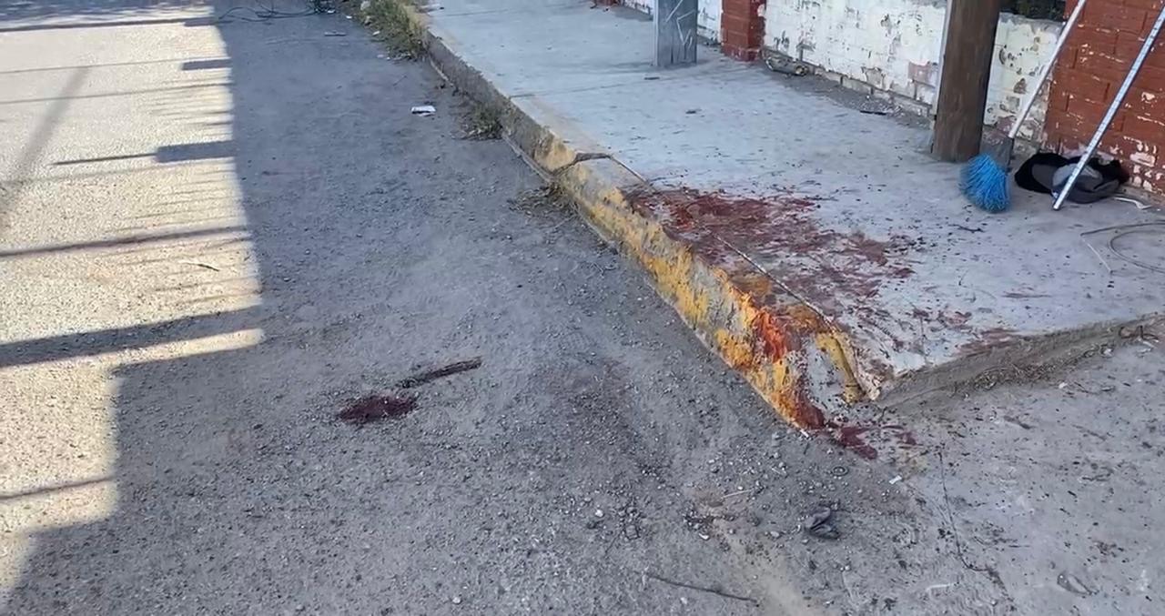 ¡PODRÍAN AMPUTARLE LAS MANOS AL ADULTO MAYOR ATACADO POR PITBULL!&nbsp;😔🚨🐶💉